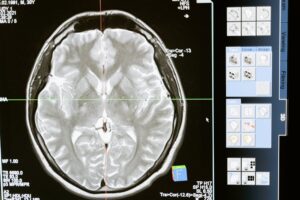 AI medical imaging