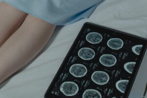 AI medical diagnosis