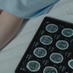 medical AI diagnosis