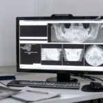 space X-ray imaging