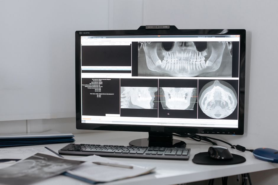 space X-ray imaging