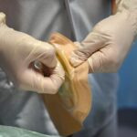 intestinal fungi radiation protection