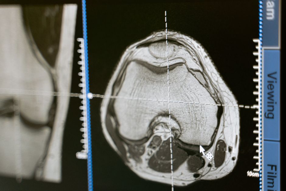 CT scan analysis